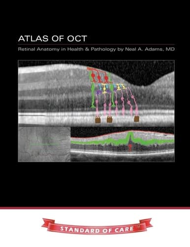 Cover of Atlas of OCT